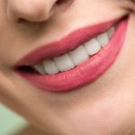 Ini Dia Keuntungan Pasang Gigi Palsu Bogor dan Tips Memasangnya
